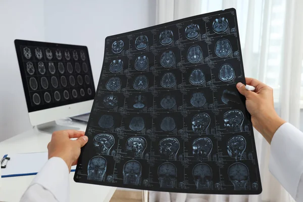 Mri Images Human Head Hands Doctor — Stock Photo, Image