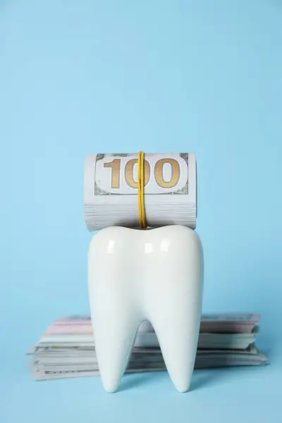 Декоративний Зуб Гроші Синьому Фоні — стокове фото