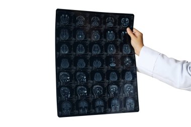 PNG, bir doktorun elinde beyaz arka planda izole edilmiş bir insan kafasının MRI görüntüleri.