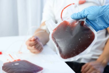 Donör kanı taşıyan çantalar, donör ve doktorun eli arka planda, kapatın.