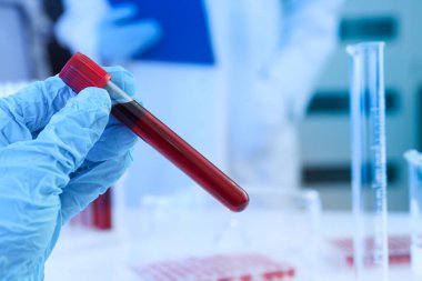 Doktorun elinde donör kanı olan test tüpleri mavi arka planda, metin için boşluk