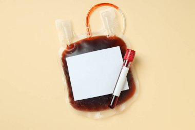 Bej arka planda donör kanı olan torba ve test tüpü.