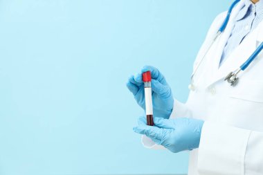 Elinde donör kanı olan doktor mavi arka planda, metin için yer var.