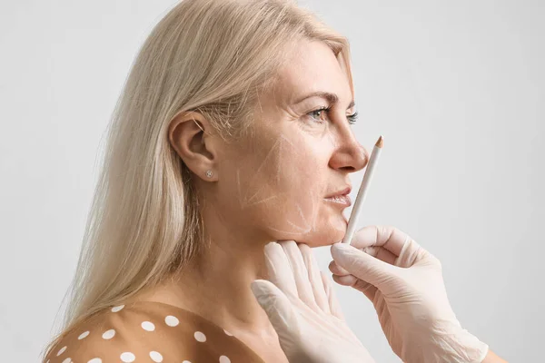 Thread facelift, concept of lifting skin. Procedure facial contouring using mesothreads. A beautician in gloves makes markings with a white pencil on a woman's face for the introduction of fillers