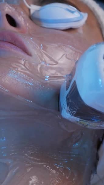 Cosmetólogo Trata Piel Una Cara Niña Con Láser — Vídeo de stock