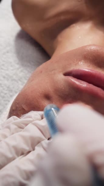 Arts Cosmetoloog Het Uitvoeren Van Naaldloze Mesotherapie Een Jonge Vrouw — Stockvideo