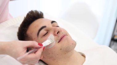Güzellik kliniğinde soyulurken esmer saçlı genç bir adam. Kozmetoloji stüdyosundaki yakışıklı adam. Deride sivilceler ve siyah noktalar var. Sivilce.