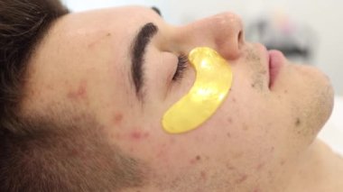 Gözlerinin altında altın bir yama olan yakışıklı bir adam. Güzellik stüdyosu. Spa salonu. Yakın plan. Deride sivilceler ve siyah noktalar var. Sivilce.
