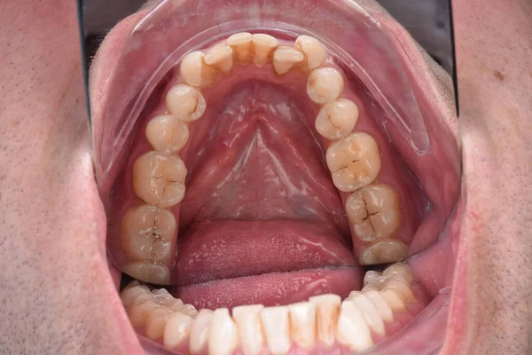 Dentiste Prenant Une Photo Gros Plan Examen Des Dents Homme — Photo