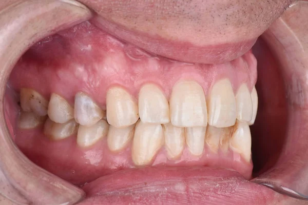 Стоматолог Фотографирует Закрыть Обследование Зубов Человека Перед Лечением Открыть Рот — стоковое фото