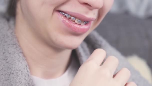 Крупный План Юный Подросток Улыбается Металлическими Скобками Зубах Время Игры — стоковое видео
