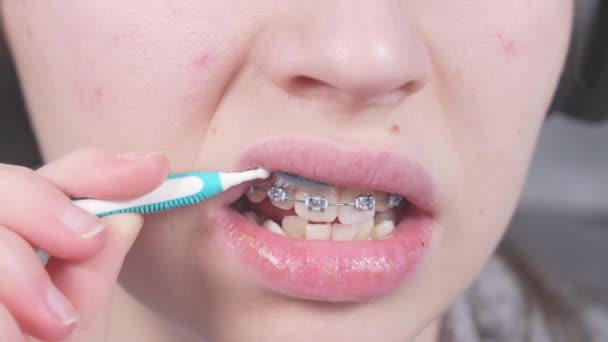 Adolescente Spazzolatura Staffe Metalliche Spazzolini Ortodontici Filo Interdentale Concetto Igiene — Video Stock