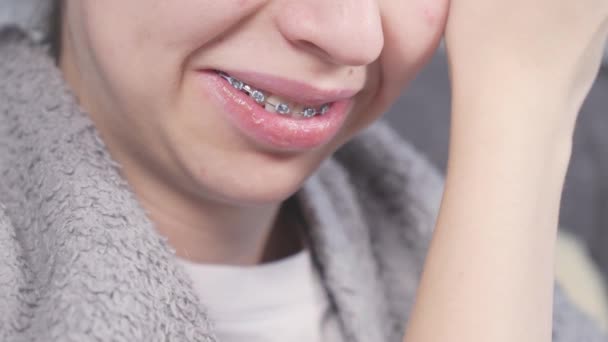 Yakın Plan Görüntüsü Genç Çocuk Telefonda Oynarken Dişlerinde Metal Parantez — Stok video