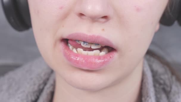 Girl Touching Her Metal Braces Tongue Close View Mouth Braces — Stock Video