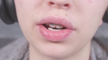 A young girl with headphones shows her teeth with metal brackets. Close up view of a woman with dental braces