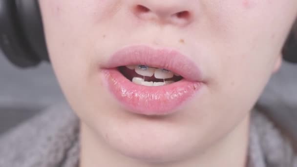 Kulaklıklı Genç Bir Kız Dişlerini Metal Parantezlerle Gösteriyor Diş Teli — Stok video
