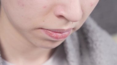 Closeup view 4k Young teenage kid smiles with metal brackets on teeth while playing on the phone. Orthodontic metal braces with transparent rubber band. Dental treatment for perfect bite