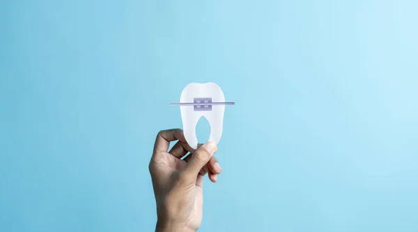Denti Dentali Esaminati Dentista Possesso Bretelle Virtuali Concetto Ortodontico — Foto Stock