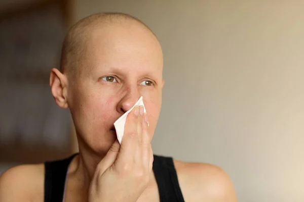 Bald cancer sick woman blowing running nose got flu cough cold, rhinitis sneezing in tissue or nosebleeds. Female is sick allergic having allergy symptoms coughing holding napkin. Misery, infelicity.