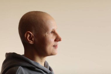 Kemoterapinin etkileri. Bin yıllık kılsız, kanser teşhisi konan komik yüz portresi radyasyon tedavisinden sonra dişsiz bir ağız gösteriyor. Diş problemi, diş kaybı..