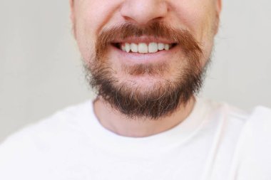 Sakallı adamın kesilmiş fotoğrafı ilk kez kabarık sakal ve bıyıktaki gri tüyler. Erken yaşta melanin kaybı, genetik yatkınlık, hormonal bozukluk, endokrin sistemi bozuklukları..