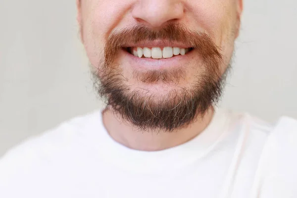 Zastřižená Fotka Vousatého Muže První Šedé Vlasy Zarostlé Chlupaté Vousy — Stock fotografie