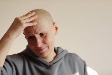 Kel kadın, kemoterapiden sonra baş ağrısı çeken elleriyle kafasına dokunuyor. Evde migreni olan mutsuz, tüysüz, kanser hastası bir kadın. Onkoloji konsepti. Sağlık, ilaç.