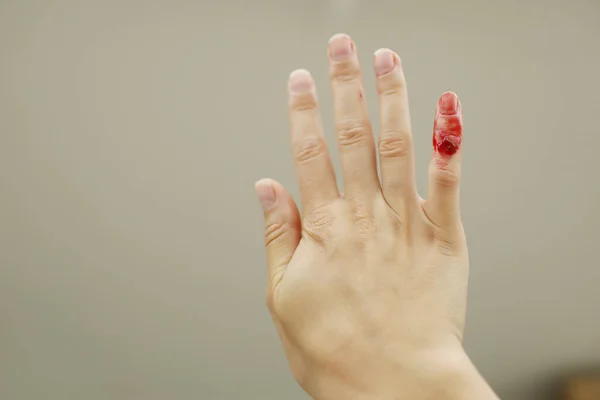 赤血の女性の手 小さな指は血を流しています 女性はナイフや他の鋭い物体で自宅で小さな指を傷つけました 傷や体の怪我の結果を出血する 国内事故 ストック画像