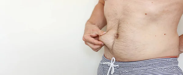 Cropped photo of man is touching his naked not fit belly waistline with loose skin suffering from extra weight. Concept of unhealthy eating and lifestyle, health problems of obese people