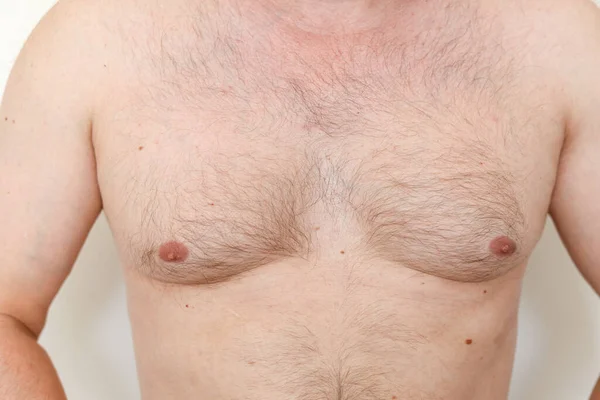 Close up of hairy man\'s chest, male nipples, light thin hair on breast unrecognisable young guy. White skin with birthmarks. Overweight, not slim.