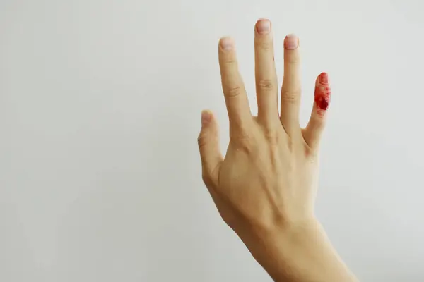 Female hand with red blood, little finger is bleeding profusely. Woman injured her little finger at home with knife or other sharp object. Bleeding wound and body injury result. Domestic accident