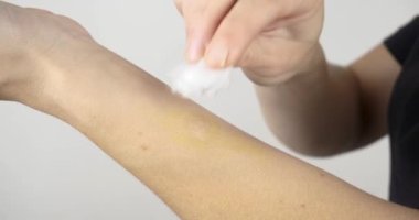 Radyasyon yanıklarını iyotla tedavi edip koldaki yarayı iyotla kayganlaştır. Yüksek kalite 4k görüntü