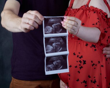 Bir adam ve bir kadın ultrason görüntüsü taşıyor. Gelecekteki mutlu ebeveynler..