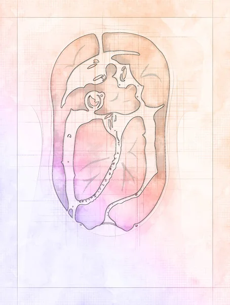 Dialisis Peritoneal Adalah Pengobatan Pengganti Untuk Alternatif Gagal Ginjal Kronis — Stok Foto