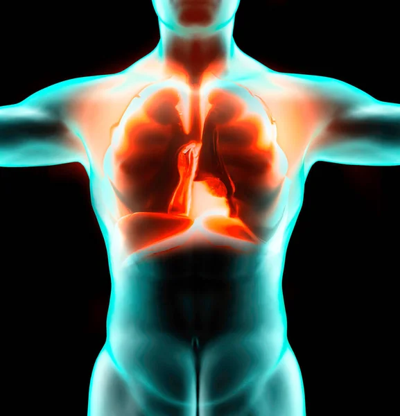 Человеческая Анатомия Проблемы Дыхательной Системой Серьезные Повреждения Легких Двусторонняя Пневмония — стоковое фото
