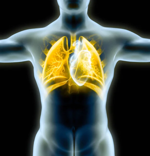Die Menschliche Anatomie Probleme Mit Den Atemwegen Schwer Geschädigte Lungen — Stockfoto