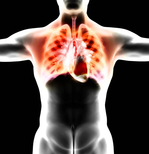 Анатомія Людини Проблеми Дихальною Системою Серйозно Пошкоджені Легені Серце Двостороння — стокове фото