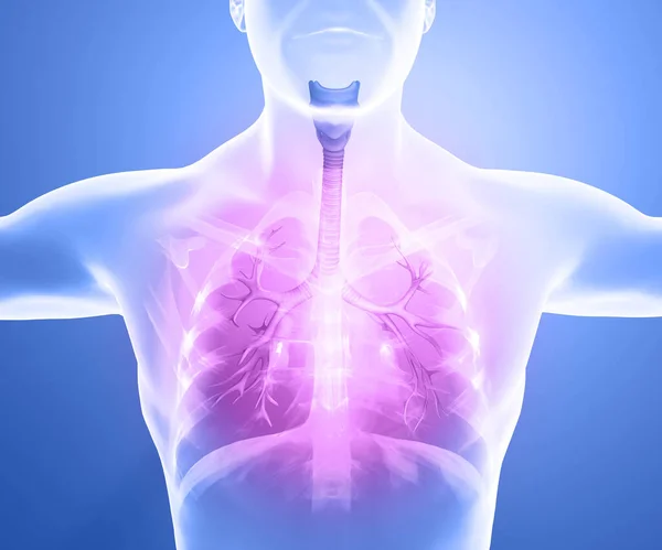 Anatomia Umana Problemi Con Sistema Respiratorio Polmoni Gravemente Danneggiati Polmonite — Foto Stock