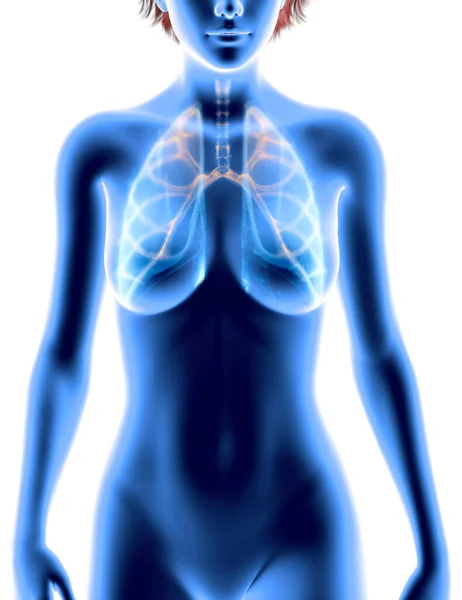 Anatomía Humana Problemas Con Sistema Respiratorio Pulmones Severamente Dañados Neumonía — Foto de Stock