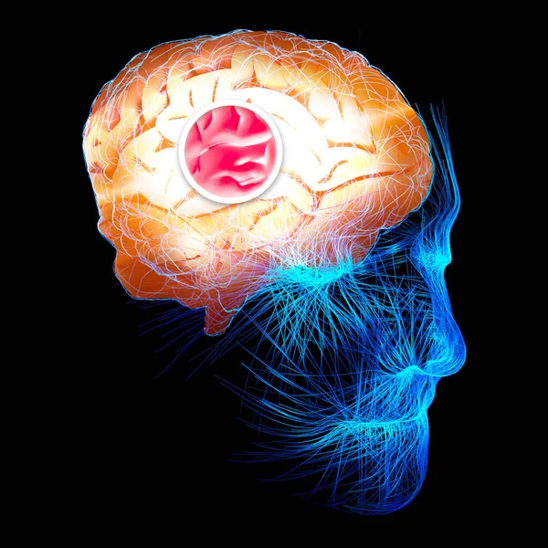 シナプスの顕微鏡的視野 脳のつながり ニューロンとシナプス コミュニケーションと脳刺激 神経回路 変性疾患 パーキンソン病 アルツハイマー病 3Dレンダリング — ストック写真
