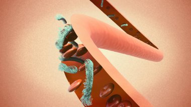 Kan akışı, damar ve kırmızı kan hücreleri ve kan zehirlenmesi. Vücudun enfeksiyona karşı tepkisinden kaynaklanan potansiyel olarak hayati tehlike taşıyan bir durum. 3d oluşturma