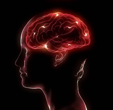 Hafıza kayıpları, bazı şeyleri unutmak, dejeneratif hastalıklar. Beyin sorunları. Parkinson ve Alzheimer hastalığı. Akıl sağlığı. Felç, sinapslar ve nöronlar etkileşime girer. 3d oluşturma