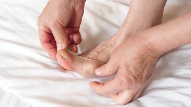 Frau Zieht Finger Silikonseparator Orthopädischer Daumenkorrektor Bein Auf Weißem Bett — Stockvideo