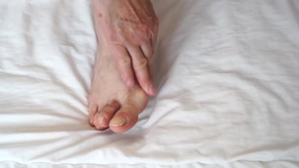 Frau Streichelt Auf Dem Bettboden Einen Abstehenden Knochen Bein — Stockvideo