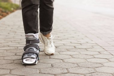 Ortopedik yürüyen botlar. Bileği yaralı bir kadın, kırık ya da bileği burkulmuş. Kırık bilek bağı, kırık bacak, kısa bacak alçı, yaralı kadın bacağı tedavisi için atel.