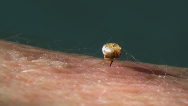 蜜蜂毒液囊 蜜蜂刺人的胳膊 蜜蜂吃完后 会离开毒液囊 注意到毒液仍在周围肌肉的压力下自行喷射 — 图库视频影像