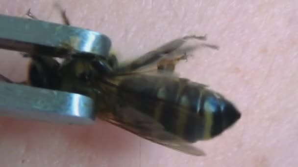 Bienentherapie Mit Hilfe Einer Pinzette Wird Die Biene Auf Die — Stockvideo