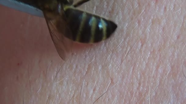 Bienentherapie Mit Hilfe Einer Pinzette Wird Die Biene Auf Die — Stockvideo