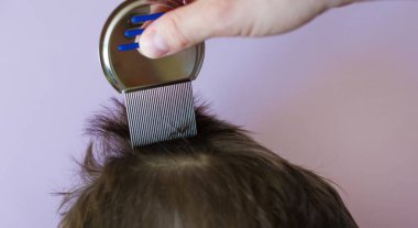 Lice comb and brunette hair on a violet background with copy space. Man using nit comb on childs hair