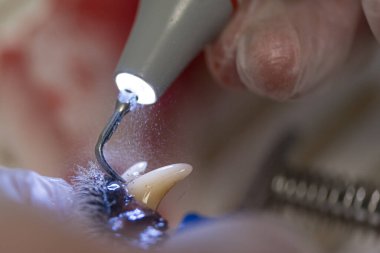 Dişçi ultrason cihazı ile bir köpeğin dişlerini temizler. Hayvan temiz beyaz dişler